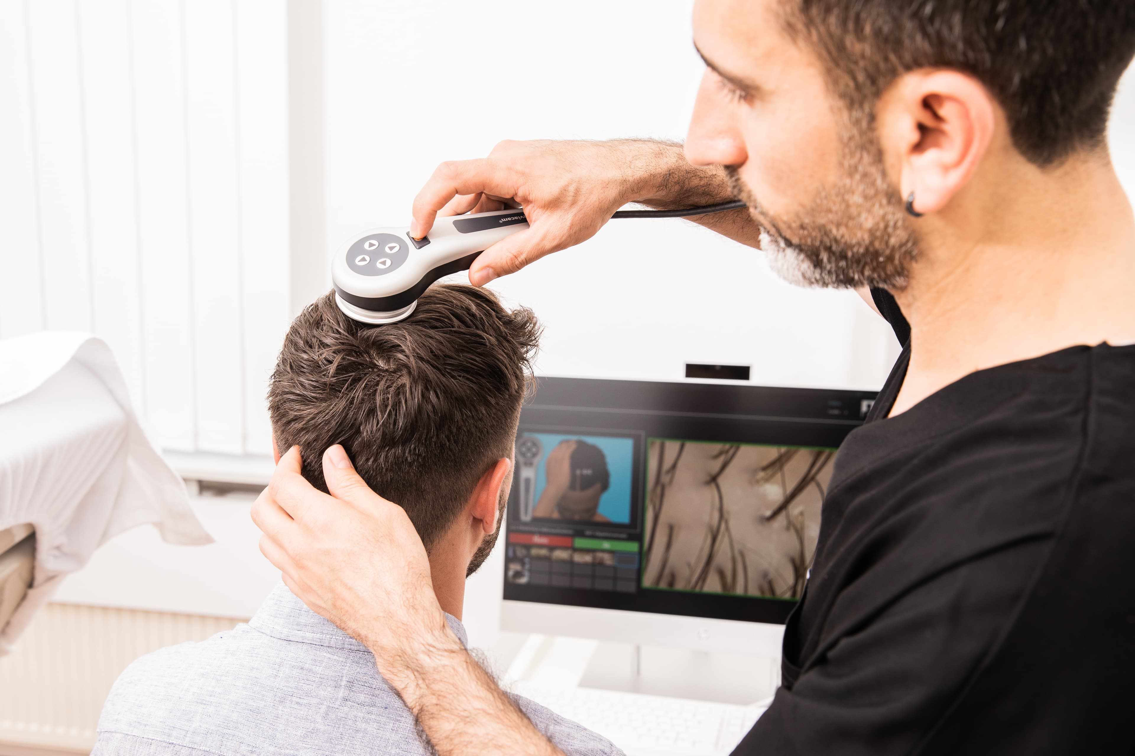 Haartransplantation